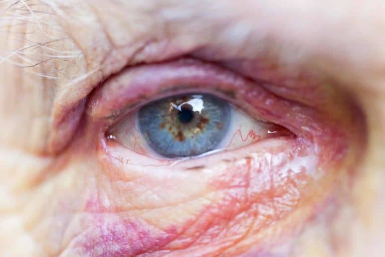 nursing home defense lawyer san diego